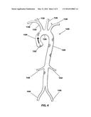 THROMBOEMBOLIC PROTECTION DEVICE diagram and image