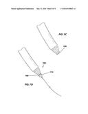 THROMBOEMBOLIC PROTECTION DEVICE diagram and image