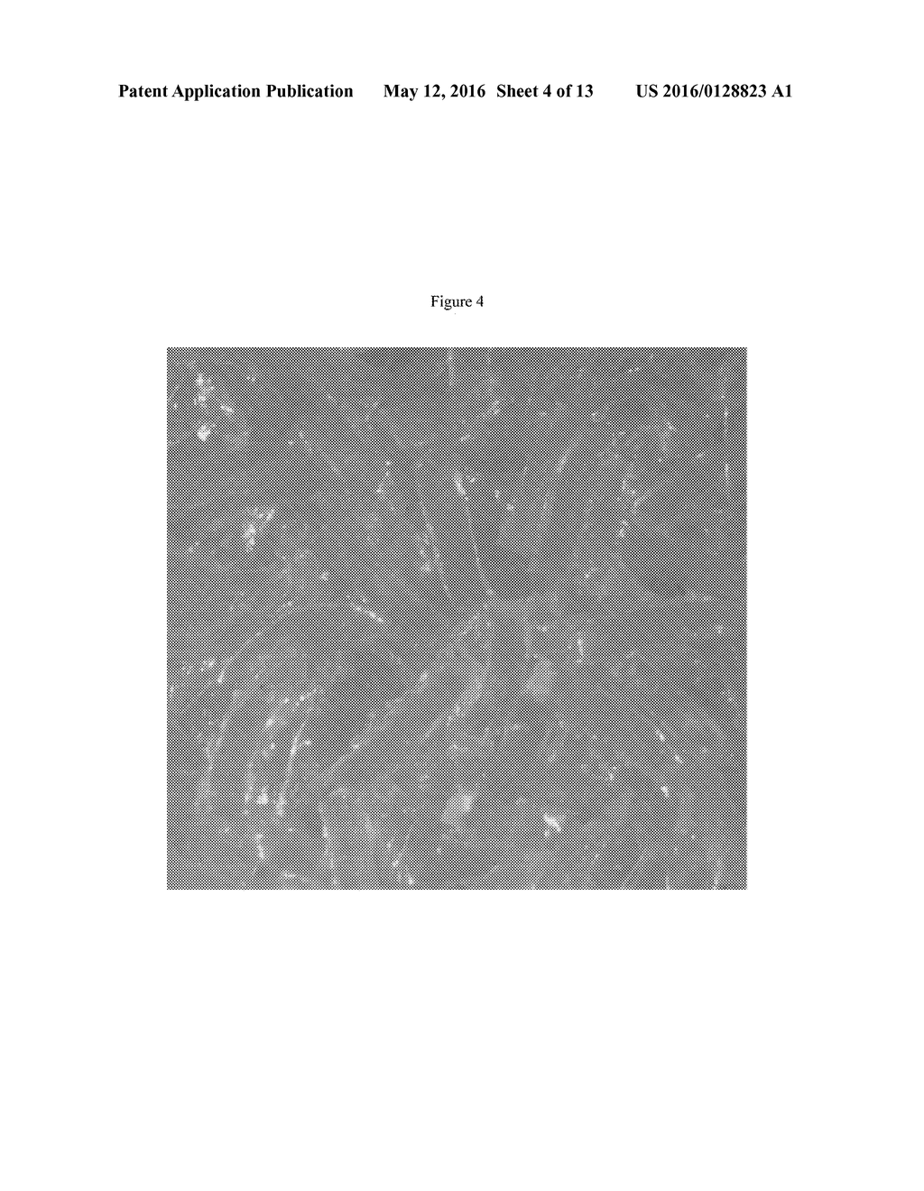 POROUS IMPLANT MATERIALS AND RELATED METHODS - diagram, schematic, and image 05