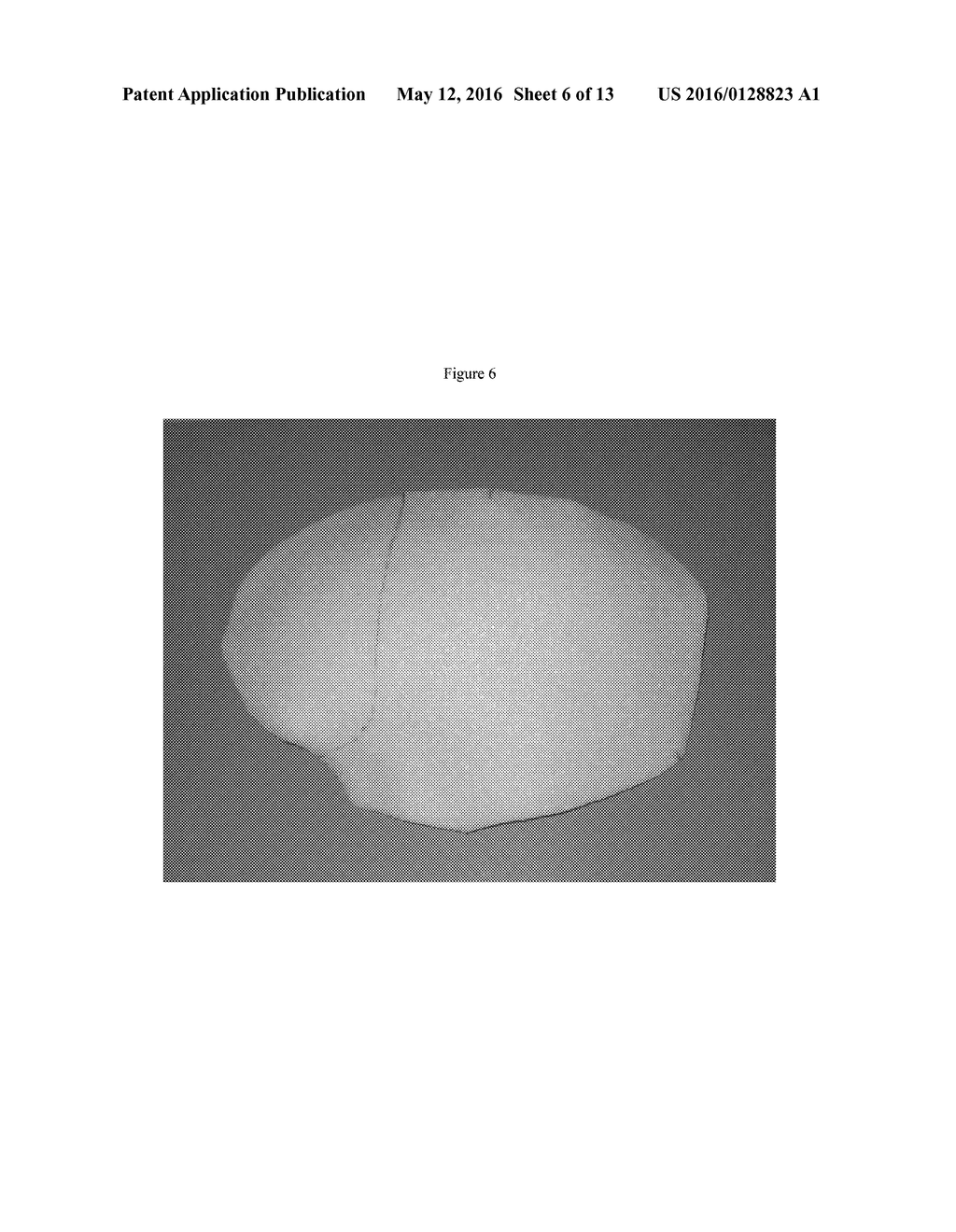 POROUS IMPLANT MATERIALS AND RELATED METHODS - diagram, schematic, and image 07