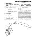 METHODS OF IMPLANTING A HEART VALVE AT AN AORTIC ANNULUS diagram and image