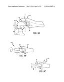 BALL AND SOCKET ASSEMBLY diagram and image