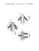 Intervertebral Implant with Fixation Geometry diagram and image