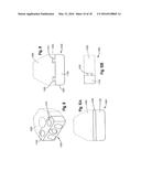 Intervertebral Implant with Fixation Geometry diagram and image