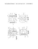 Intervertebral Implant with Fixation Geometry diagram and image