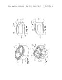 Intervertebral Implant with Fixation Geometry diagram and image