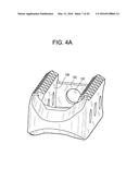 Composite Vertebral Spacers and Instrument diagram and image