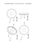 METHODS AND SYSTEMS FOR DELIVERING AN IMPLANT USING A PLANETARY GEAR     ACTUATION ASSEMBLY diagram and image