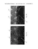 Process and Apparatus for Manufacturing an Absorbent Article Using a Laser     Source diagram and image