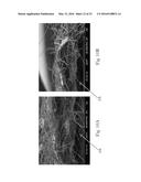 Process and Apparatus for Manufacturing an Absorbent Article Using a Laser     Source diagram and image