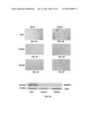 Methods and Compositions for the Treatment of Body Weight Related     Disorders diagram and image