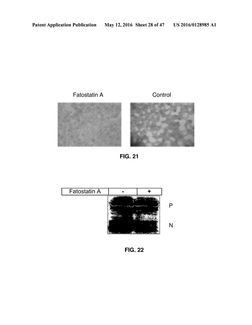 Methods and Compositions for the Treatment of Body Weight Related     Disorders - diagram, schematic, and image 29