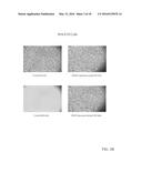 Glutathione Disulfide Compositions and Related Methods for the Treatment     of Cancer diagram and image