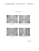 Glutathione Disulfide Compositions and Related Methods for the Treatment     of Cancer diagram and image