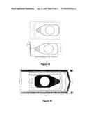 AMNIOTIC MEMBRANE diagram and image