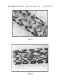 Protected Magnesium Alloys for Bioresorbable Stents diagram and image