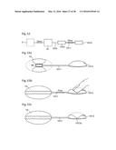 HEART HELP PUMP, SYSTEM, AND METHOD diagram and image