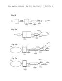 HEART HELP PUMP, SYSTEM, AND METHOD diagram and image