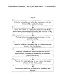 HEART HELP PUMP, SYSTEM, AND METHOD diagram and image