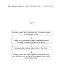 HEART HELP PUMP, SYSTEM, AND METHOD diagram and image