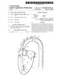 INTRACARDIAC PUMPING DEVICE diagram and image