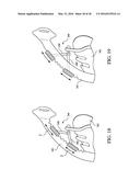 PATIENT INTERFACE WITH AN ADJUSTABLE CUSHION diagram and image