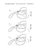 PATIENT INTERFACE WITH AN ADJUSTABLE CUSHION diagram and image