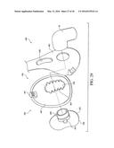 PATIENT INTERFACE WITH AN ADJUSTABLE CUSHION diagram and image