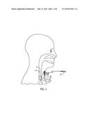 COMPRESSIBLE CANNULA CONNECTOR WITH RELEASE GRIP diagram and image