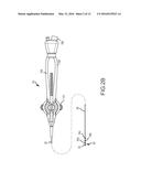 PRINTED ELECTRODE CATHETER diagram and image