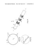 PRINTED ELECTRODE CATHETER diagram and image