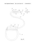 SYSTEMS AND METHODS FOR MAKING AND USING IMPROVED CONTACT ARRAYS FOR     ELECTRICAL STIMULATION SYSTEMS diagram and image