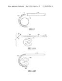 SYSTEMS AND METHODS FOR DELIVERING ELECTRIC CURRENT FOR SPINAL CORD     STIMULATION diagram and image