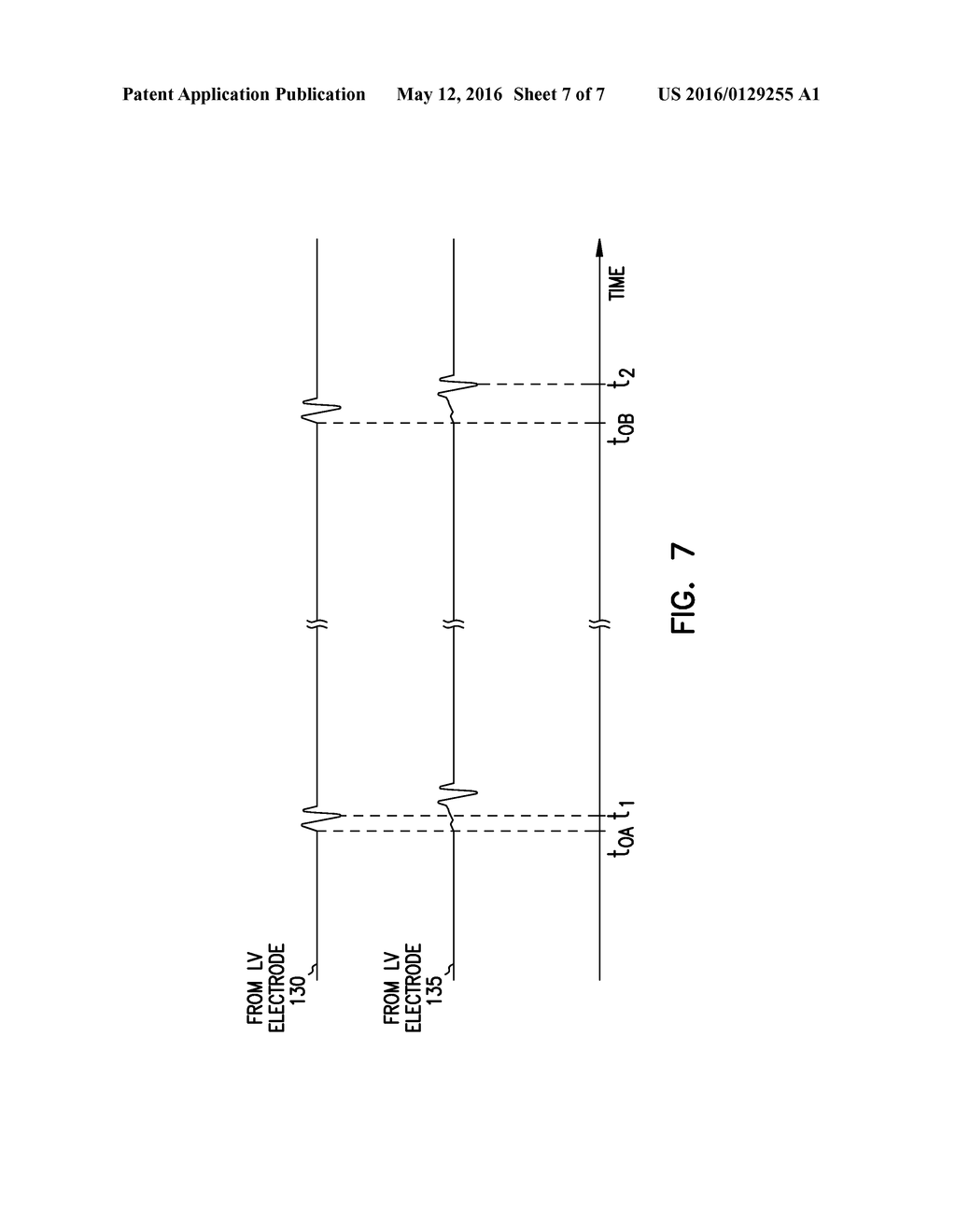 CARDIAC RHYTHM MANAGEMENT SYSTEM SELECTING BETWEEN MULTIPLE SAME-CHAMBER     ELECTRODES FOR DELIVERING CARDIAC THERAPY - diagram, schematic, and image 08