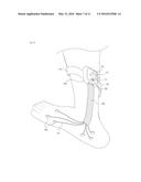 THERAPY DEVICE FOR EDEMA AND NEUROPATHY diagram and image