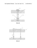 MULTISTAGE EJECTION OF AN INJECTION MOLDED MATERIAL diagram and image