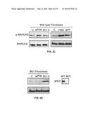 COMPOSITIONS AND METHODS FOR SPECIFIC REGULATION OF PYRUVATE DEHYDROGENASE     KINASE diagram and image