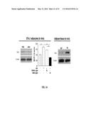 NOTCH INHIBITION IN THE TREATMENT AND PREVENTION OF OBESITY diagram and image