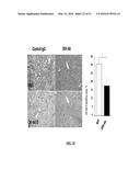 NOTCH INHIBITION IN THE TREATMENT AND PREVENTION OF OBESITY diagram and image