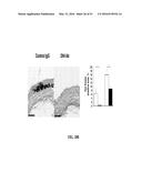 NOTCH INHIBITION IN THE TREATMENT AND PREVENTION OF OBESITY diagram and image