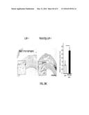 NOTCH INHIBITION IN THE TREATMENT AND PREVENTION OF OBESITY diagram and image