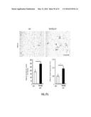 NOTCH INHIBITION IN THE TREATMENT AND PREVENTION OF OBESITY diagram and image