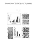 NOVEL ANTI-NODAL ANTIBODIES AND METHODS OF USING SAME diagram and image