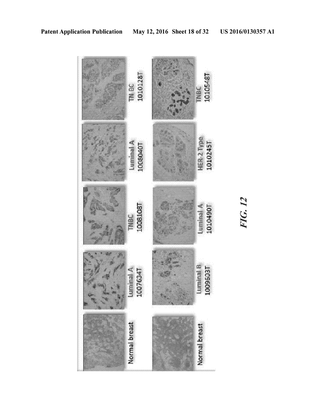 COMPOSITIONS COMPRISING CHIMERIC ANTIGEN RECEPTORS, T CELLS COMPRISING THE     SAME, AND METHODS OF USING THE SAME - diagram, schematic, and image 19