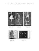 COMPOSITIONS COMPRISING CHIMERIC ANTIGEN RECEPTORS, T CELLS COMPRISING THE     SAME, AND METHODS OF USING THE SAME diagram and image