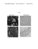 TUMOR MARKER, MONOCLONAL ANTIBODIES AND METHODS OF USE THEREOF diagram and image