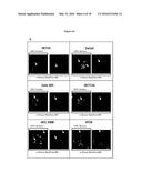 TUMOR MARKER, MONOCLONAL ANTIBODIES AND METHODS OF USE THEREOF diagram and image