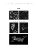 TUMOR MARKER, MONOCLONAL ANTIBODIES AND METHODS OF USE THEREOF diagram and image