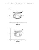 NONPARAMETRIC MODEL FOR DETECTION OF SPATIALLY DIVERSE TEMPORAL PATTERNS diagram and image