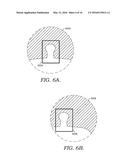 Marking And Tracking An Area Of Interest During Endoscopy diagram and image